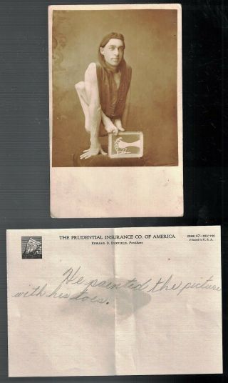 Rare 1910 Rppc Real Photo Deformed Man Who Paints With His Toes