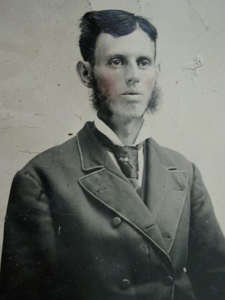 Antique Tintype Photo Portrait Of A Strange Looking Dude With Sideburns
