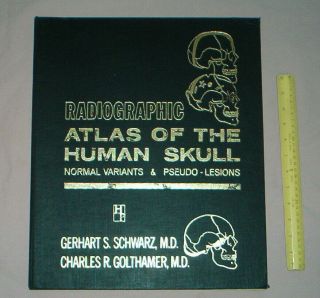 Rare / Vintage Atlas Of The Human Skull - Schwarz / Golthamer - 1965 Medical Book