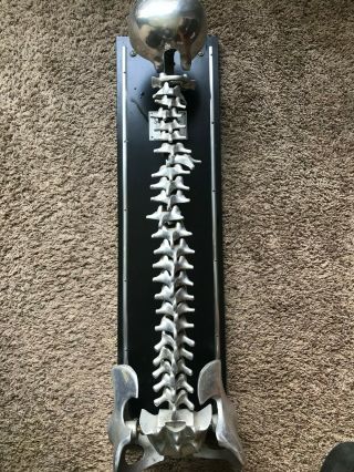 Chiropractic Dr Fleets Spinal Demonstrator Model 9 Rare