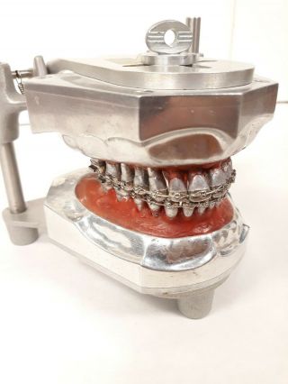 Rare Metal Orthodontists Columbia Dentoform Dental Training Trainer Teeth Model