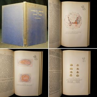 1899 Syphilitic Disases Of The Spinal Cord Rare Medical R.  T.  Williamson 1st Edn