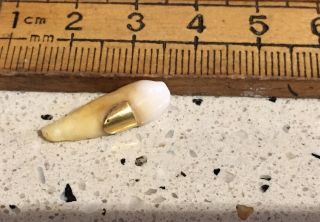 Antique Tooth With Gold,  Antique Gold Tooth 3