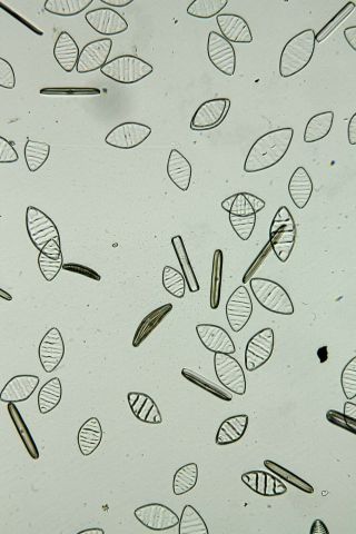 Antique Microscope Slide By J.  D.  Moller.  Diatoms.  Cymatopleura Nobilis.
