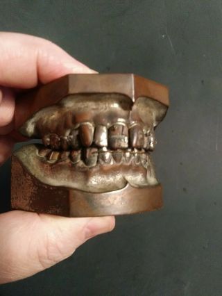 Dental Typodont Columbia Dentoform Metal Antique Rare Braces? 225 L & U