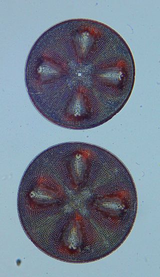 Antique Microscope Slide By W.  A.  Firth.  Diatoms.  Aulacodiscus Formosus.  Bolivia.