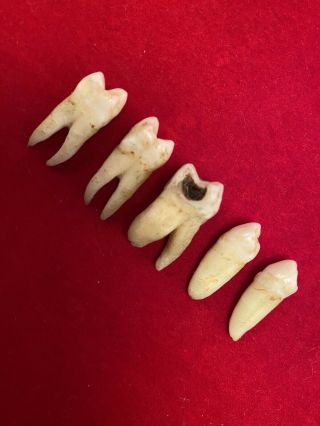 5 Human Teeth Dental Research Dental Studies Vintage Molar Canine Premolar