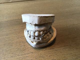 Vintage Ceramic Mold For Dentures Full Set Upper Lower False Teeth Dental