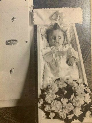 Post Mortem Silver Gel Photo Of Young Girl Possible Id