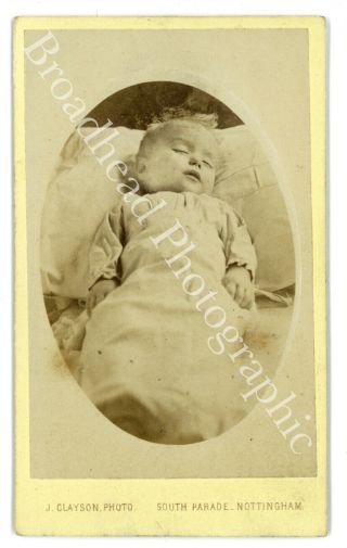 Cdv Of Post Mortem Baby By John Clayson Of Nottingham C.  1875 (300421_14)